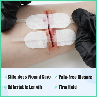 Emergency Wound Closure Kit – No-Stitch Zip Repair (6pcs)