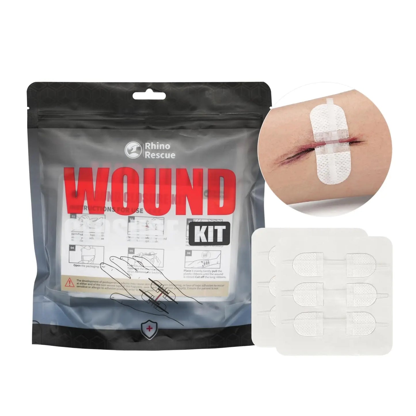 Emergency Wound Closure Kit – No-Stitch Zip Repair (6pcs)