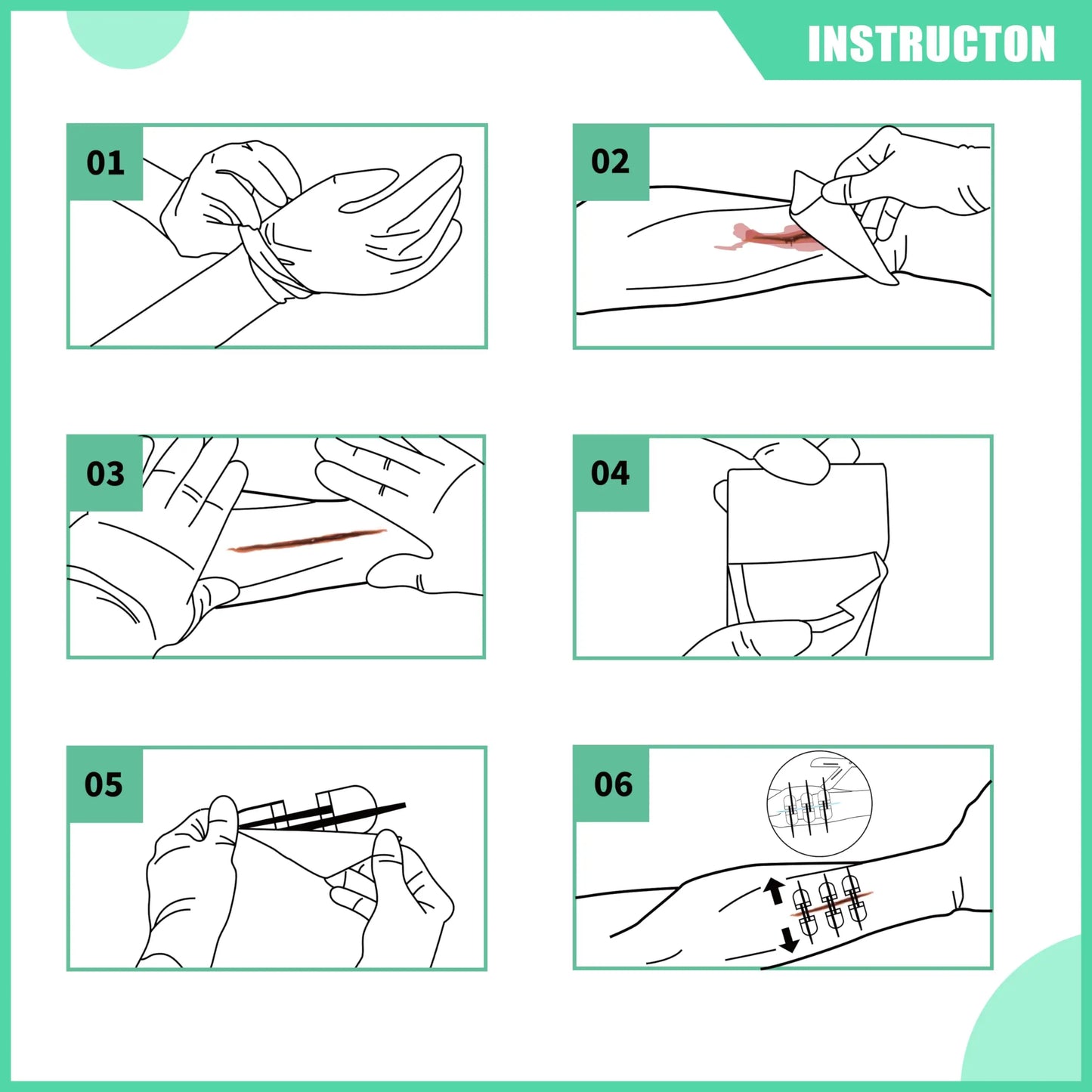 Emergency Wound Closure Kit – No-Stitch Zip Repair (6pcs)